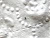 Dandruff and Black Specks-stuff03.jpg